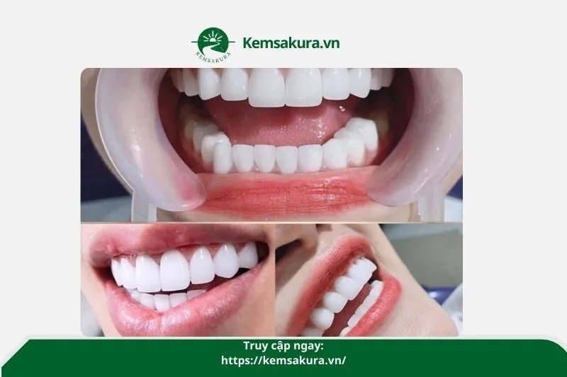 Nha khoa BS Diệc Chí Thành