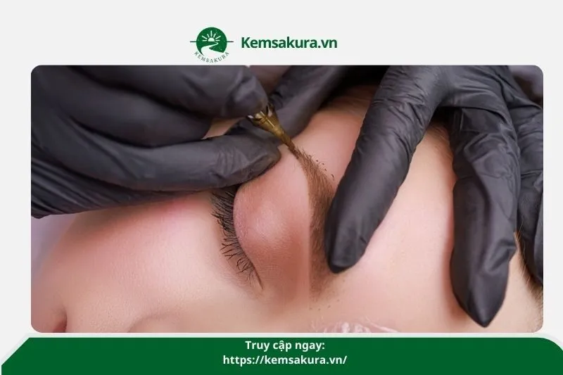 Thẩm mỹ viện Hà Anh